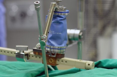 Israeli Spine Assist Device